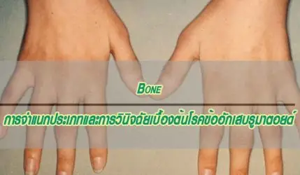 Bone การจำแนกประเภทและการวินิจฉัยเบื้องต้นโรคข้ออักเสบรูมาตอยด์