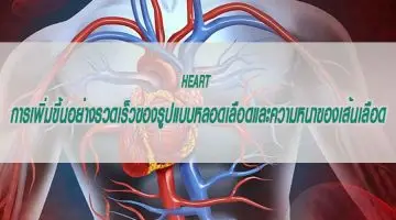 heart การเพิ่มขึ้นอย่างรวดเร็วของรูปแบบหลอดเลือดและความหนาของเส้นเลือด